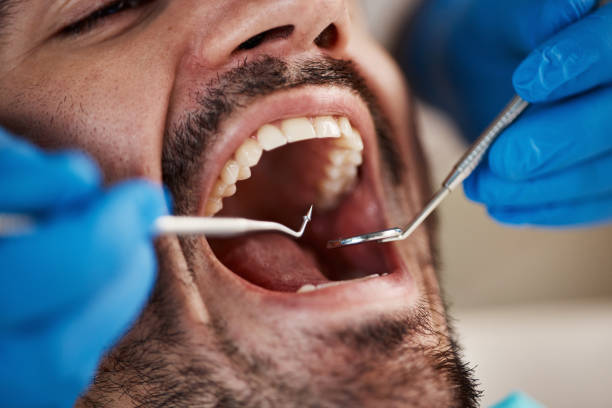 Best Emergency Root Canal Therapy in Hazen, AR
